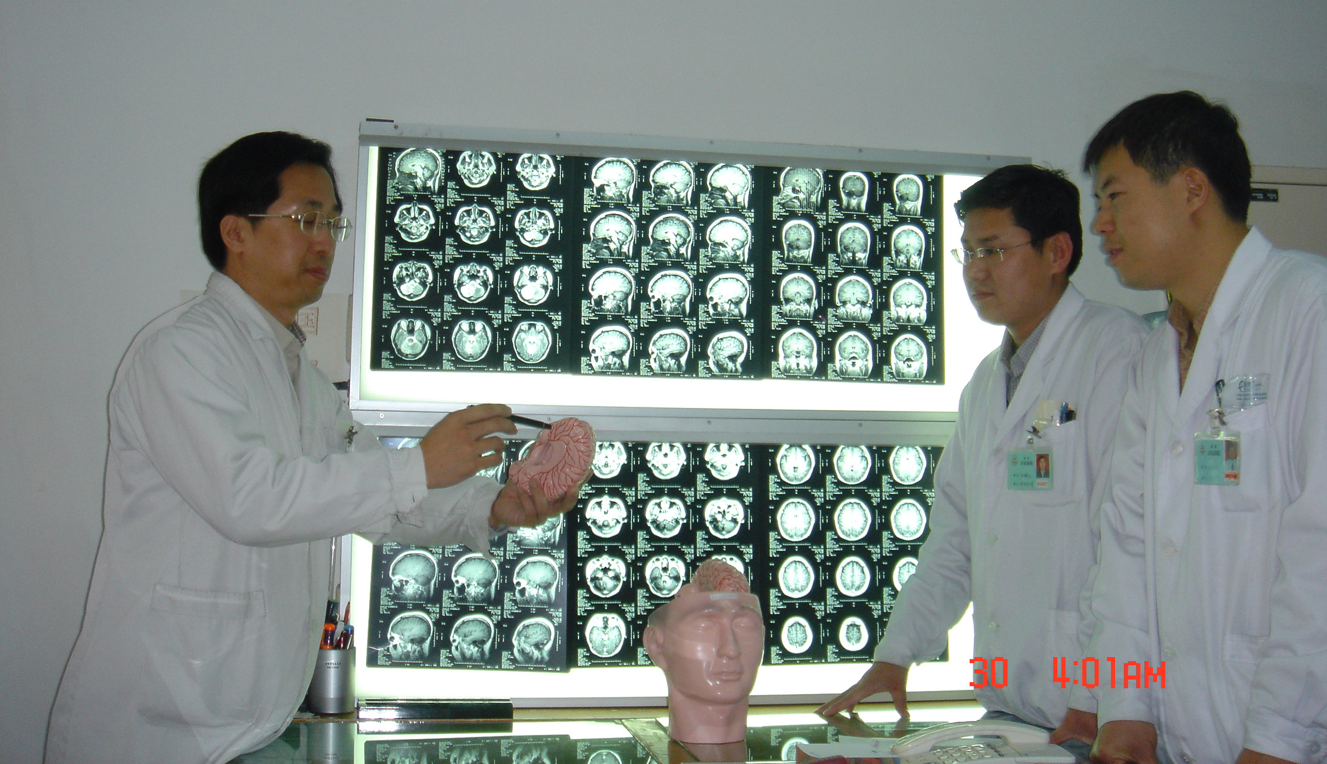 脊索瘤 北京天坛医院图片